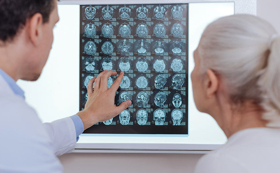 Best neurologist near me in south bay los angeles providence medical