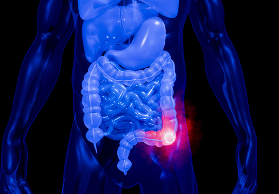 Colon Cancer Screening:<br>Why It Matters